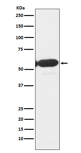 PFKFB3 Ab