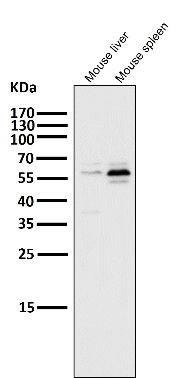 PFKFB3 Ab