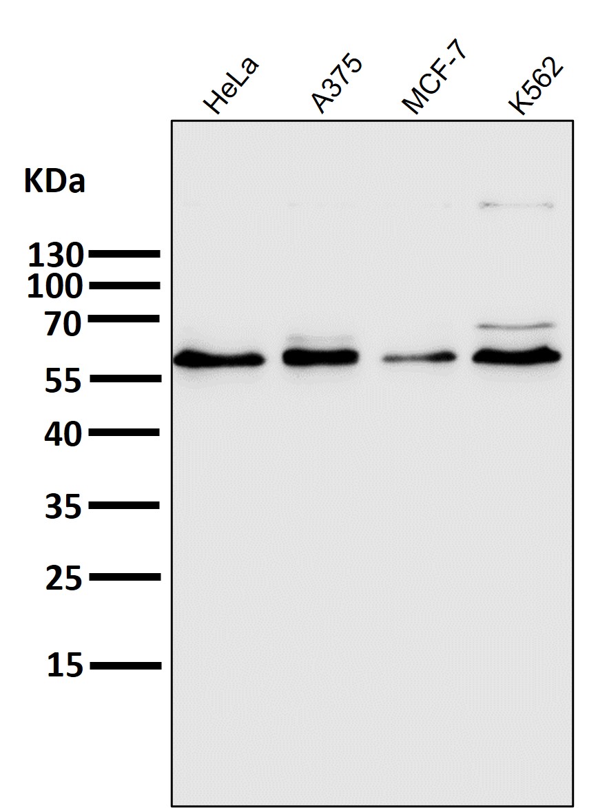 PFKFB3 Ab