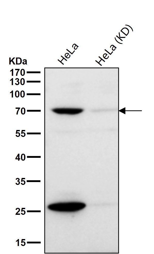 RPA p70 Ab