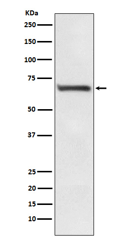 RPA p70 Ab