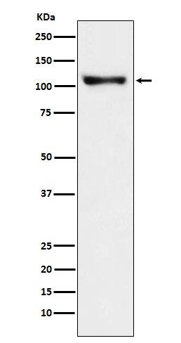 Disks large homolog 2 Ab