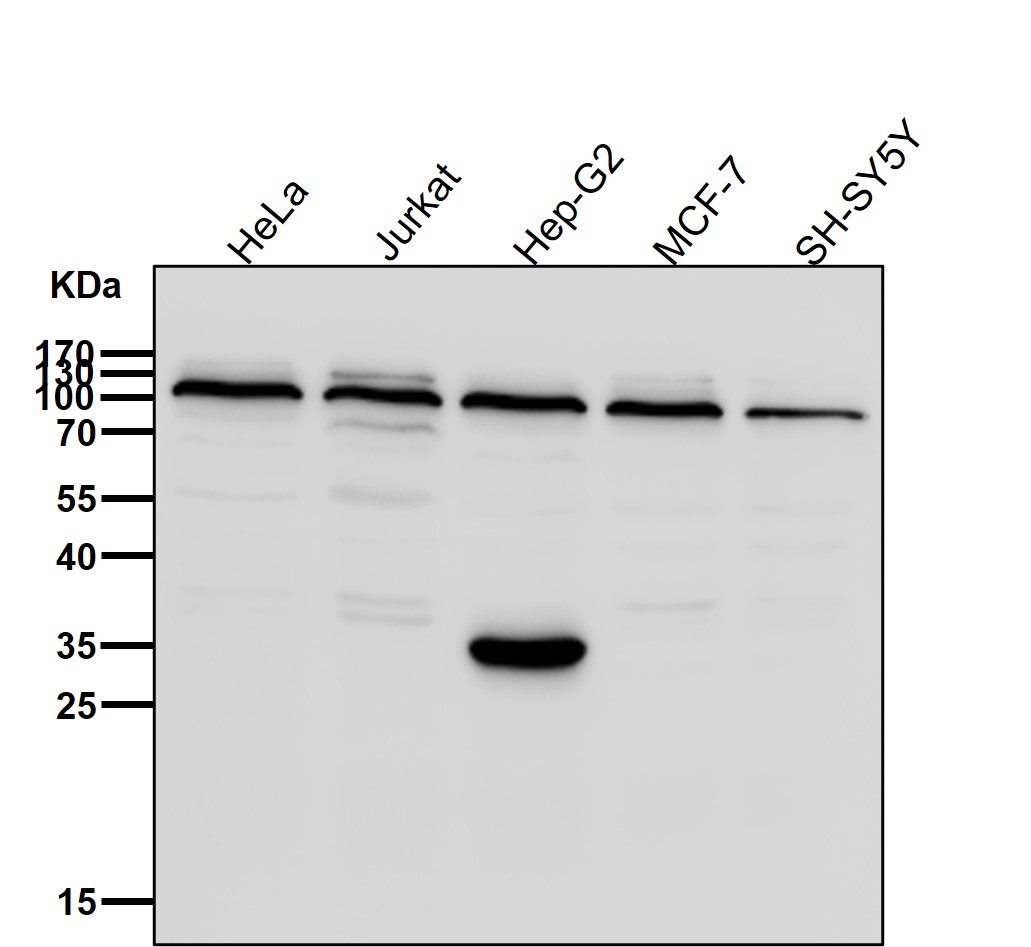 Disks large homolog 2 Ab