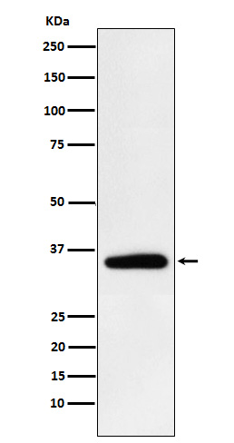 PDHB Ab