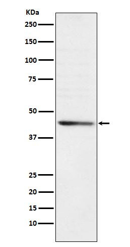 RRM2 Ab