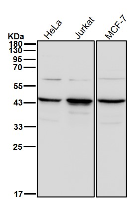 RRM2 Ab