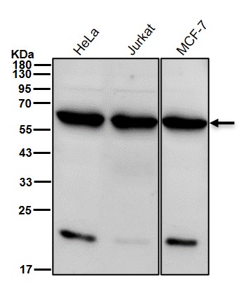 KPNA2 Ab