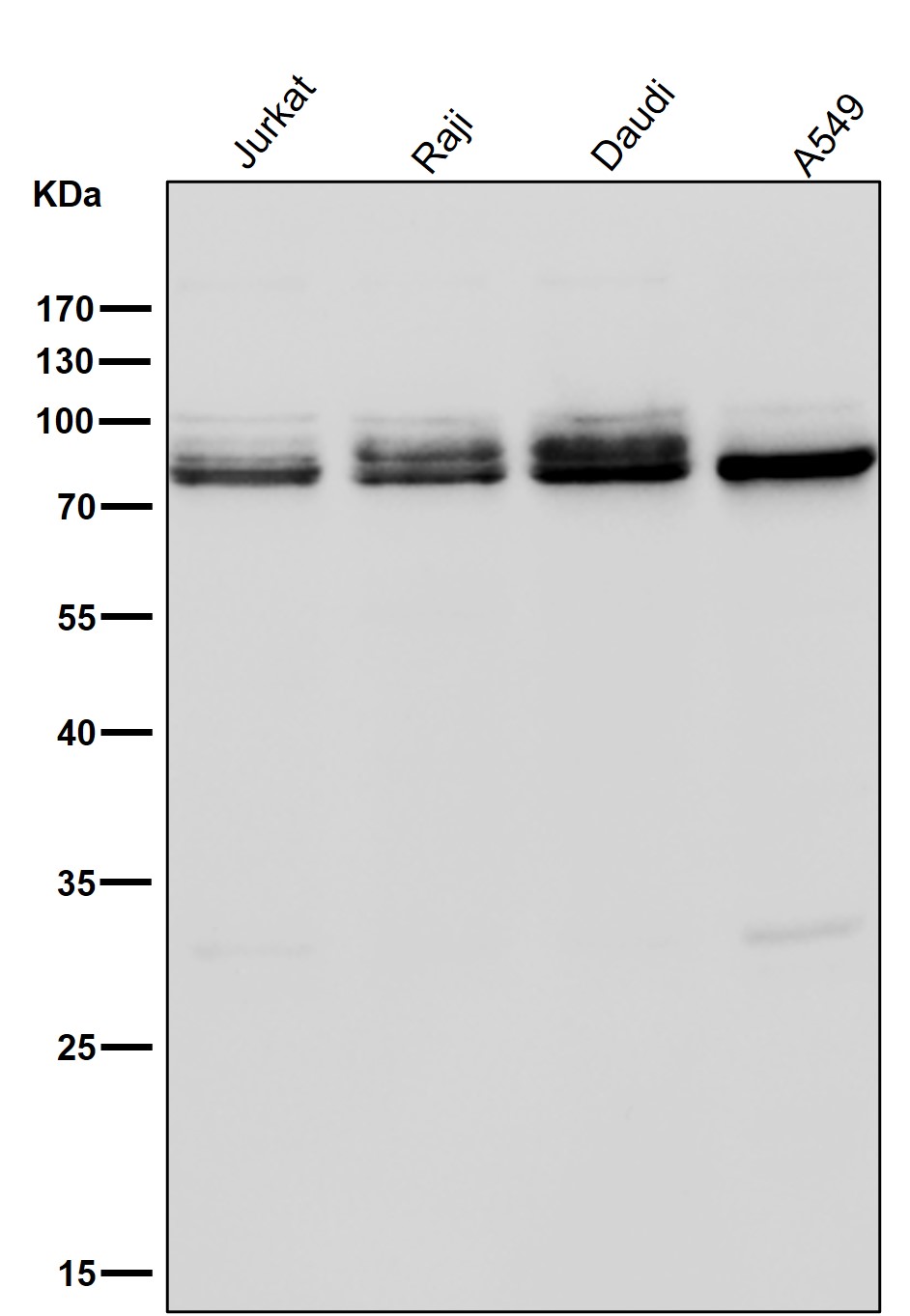 PDCD6IP Ab