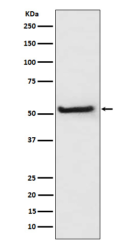 TXNIP Ab