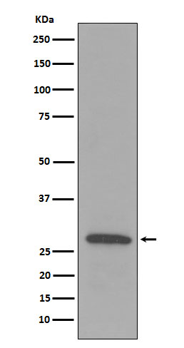 Complement C1q B Ab