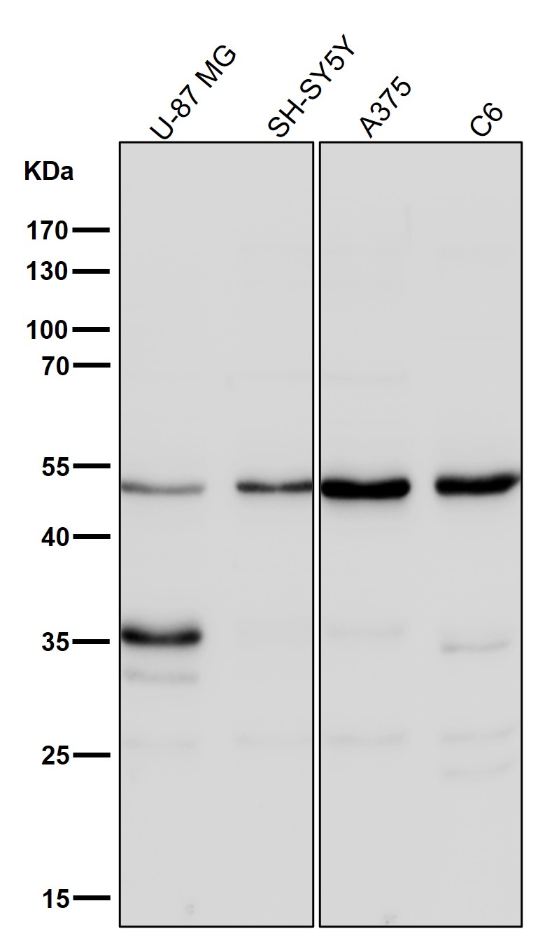 CaMKII beta/gamma Ab