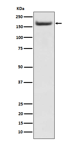 Insulin receptor substrate 2 Ab