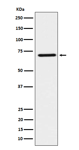 HNF 1 beta Ab