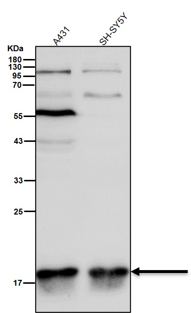 HMGA1 Ab