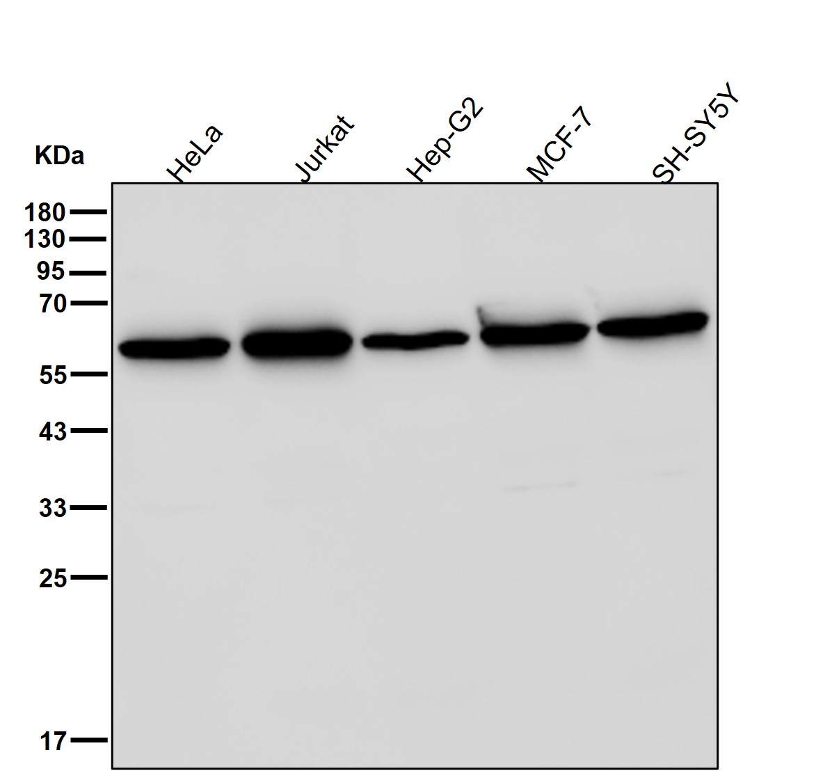 UAP1 Ab