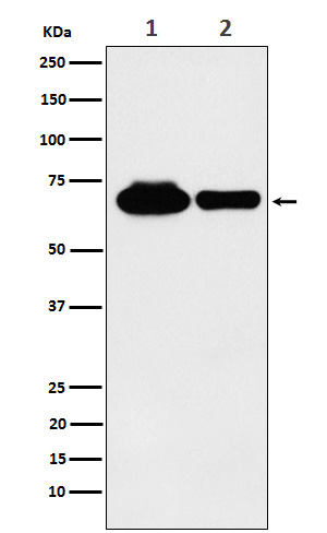 METTL3 Ab