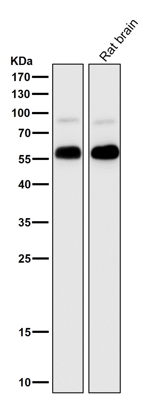 METTL3 Ab