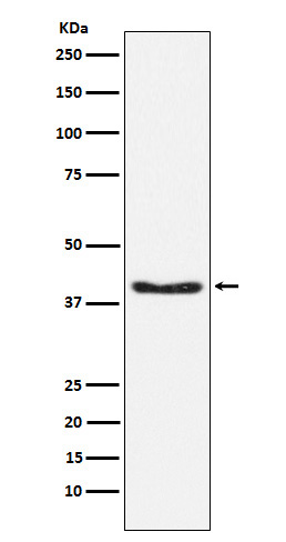 p-PDHA1 (S293) Ab