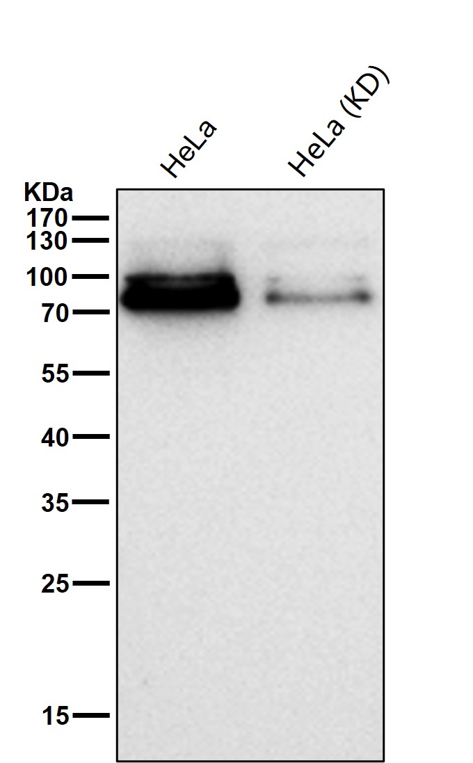 PPM1G Ab