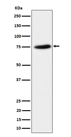 PPM1G Ab