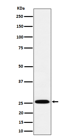 Indolamine N methyltransferase Ab