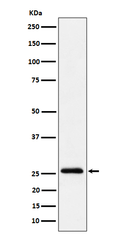 Indolamine N methyltransferase Ab