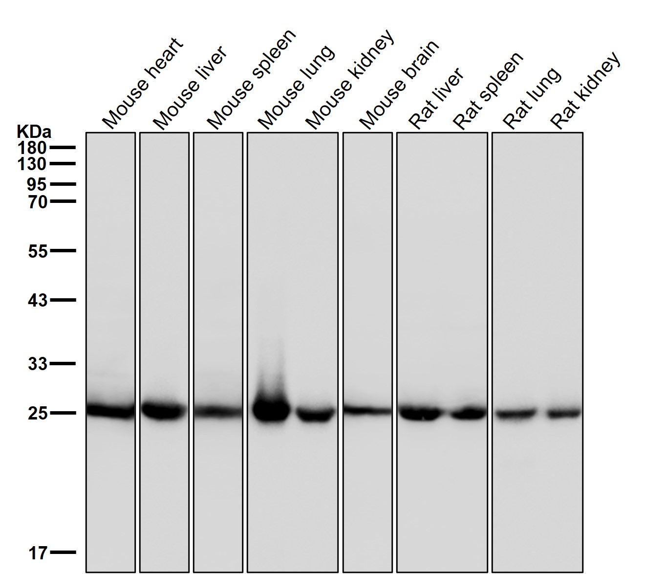 Indolamine N methyltransferase Ab