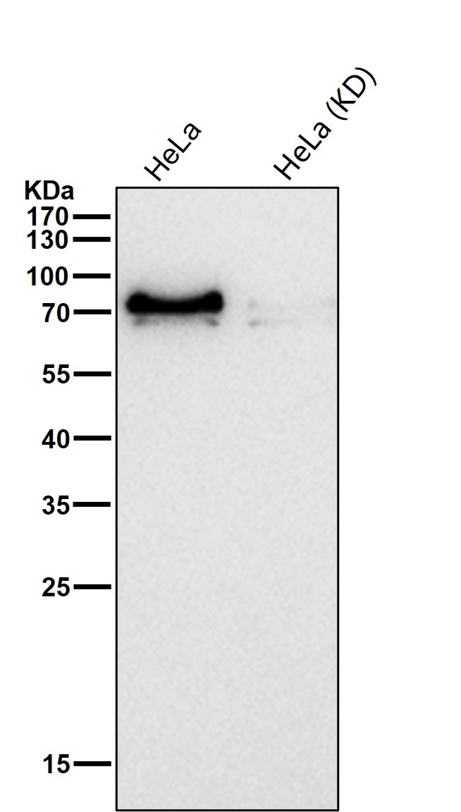 PPM1G Ab