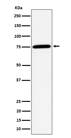 PPM1G Ab