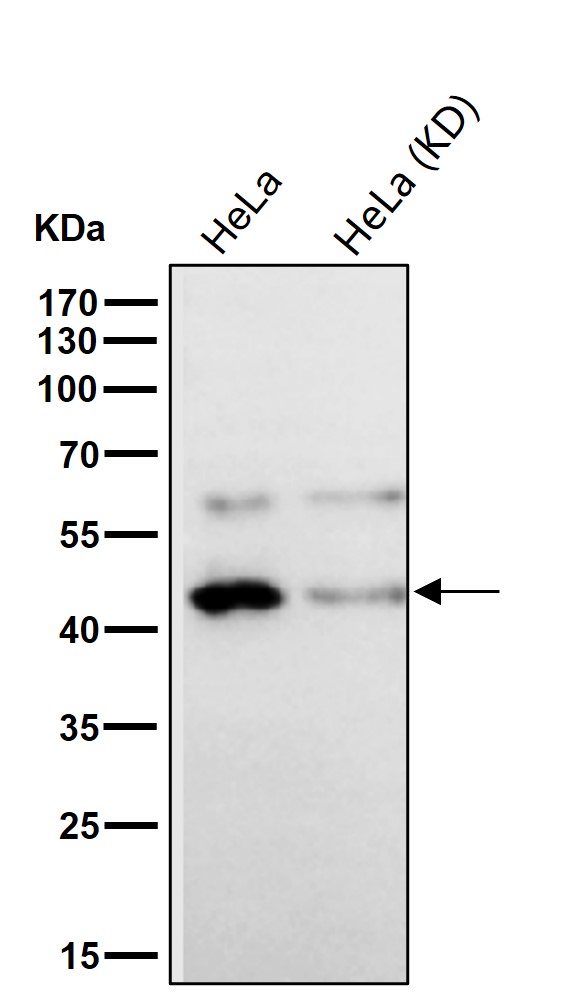 Sorting nexin 5 Ab