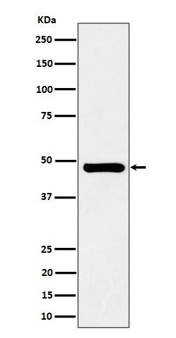 Sorting nexin 5 Ab