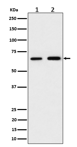 PGM 1 Ab