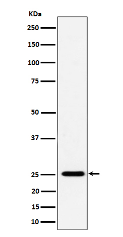 Complement factor D Ab