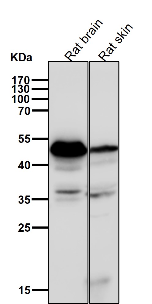 Sorting nexin 4 Ab