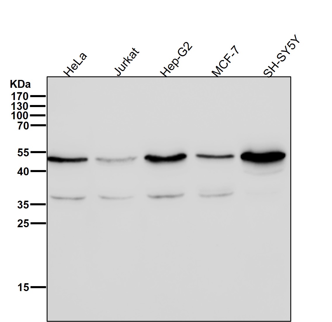 Sorting nexin 4 Ab