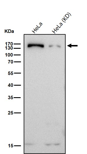 NUP155 Ab