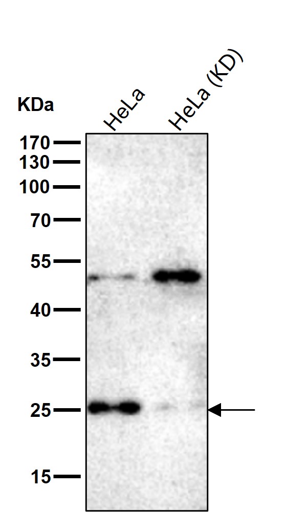 Polyamine modulated factor 1 Ab