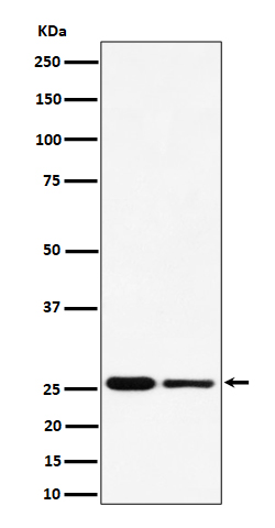 Polyamine modulated factor 1 Ab