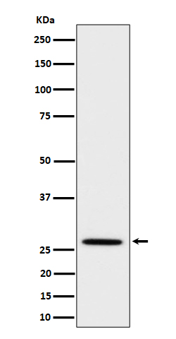 Adiponectin Ab