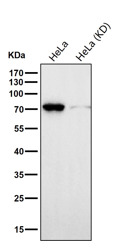 SLC25A12 Ab