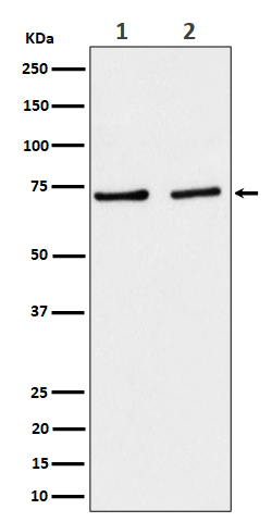 SLC25A12 Ab