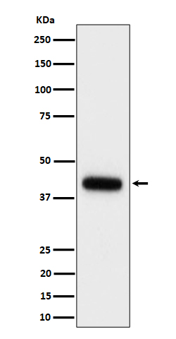 Clusterin Ab