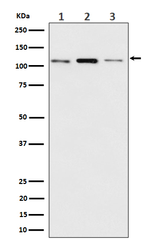 Meckelin Ab