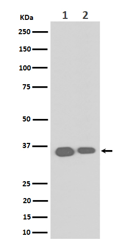 ELOVL5 Ab