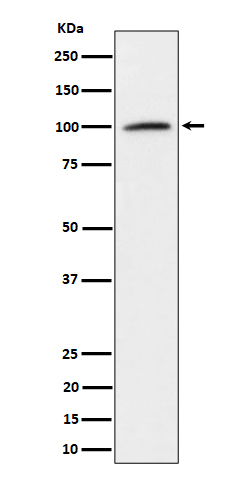 NCL Ab