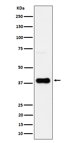 CXCR6 Ab