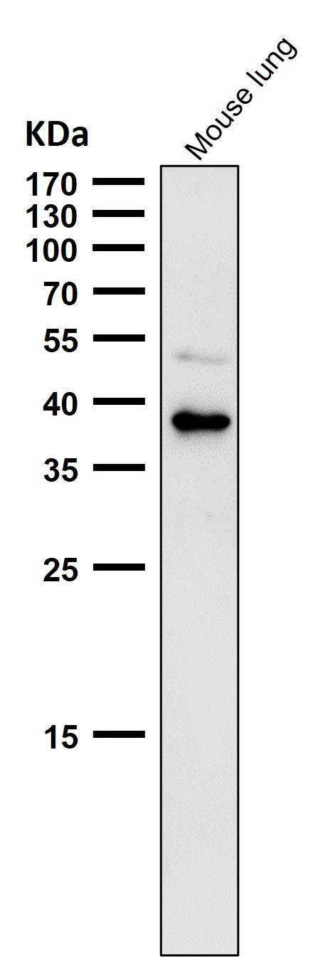 CXCR6 Ab