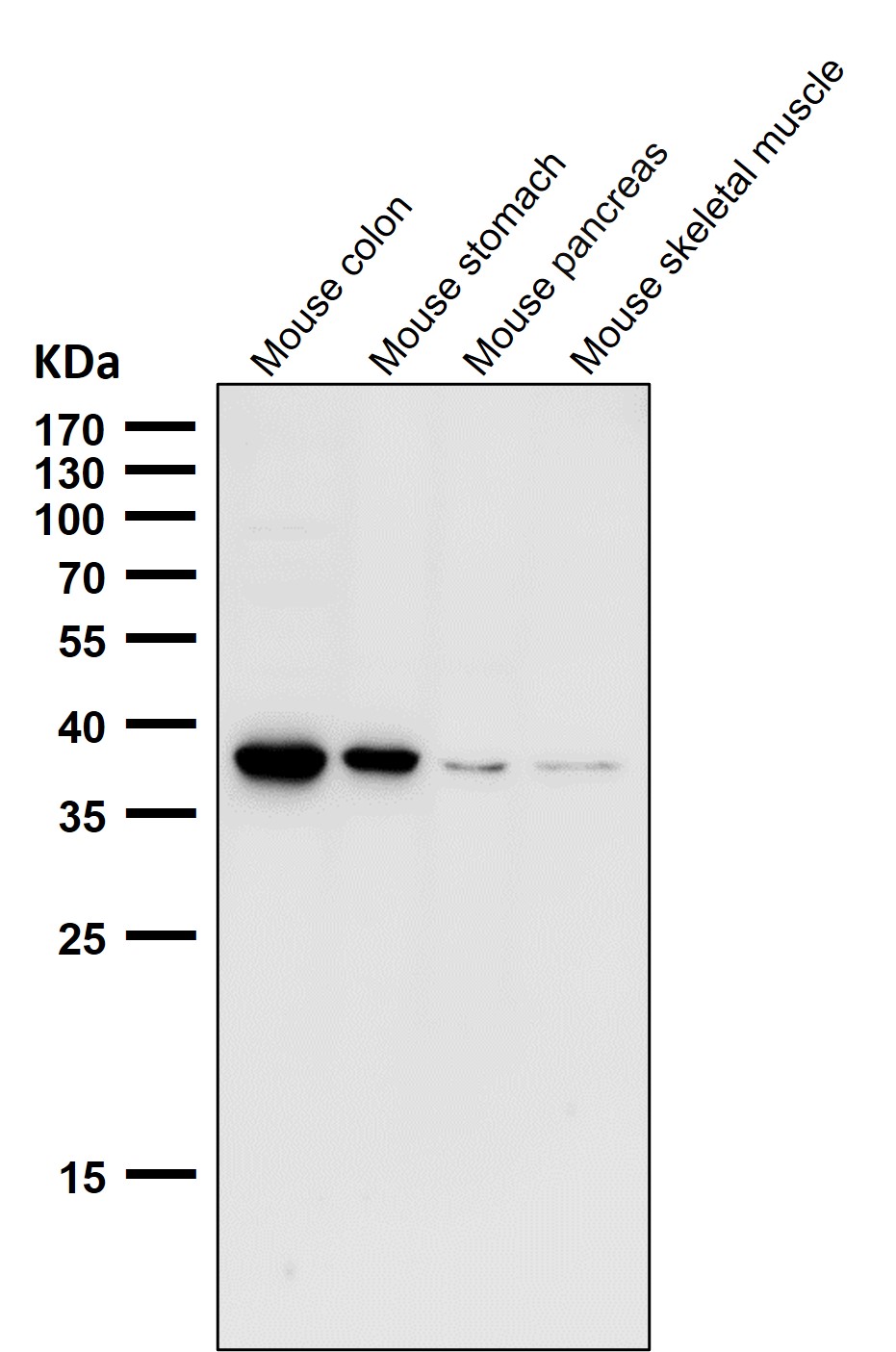 CXCR6 Ab