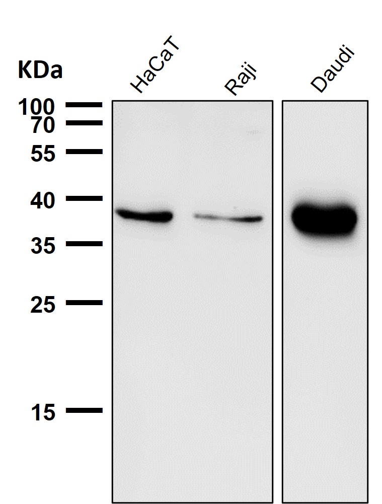 CXCR6 Ab