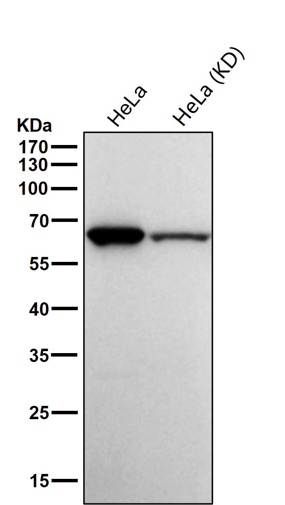 Parafibromin Ab